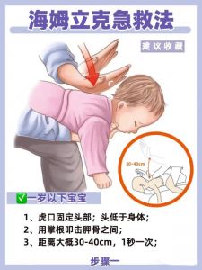 海姆立克法