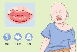 單純皰疹